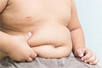 Các biện pháp giảm cân cho trẻ béo phì và quan niệm sai lầm cần tránh